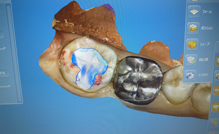 白く美しい歯になりたい方にぴったり