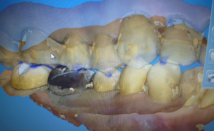 治療システムの流れ