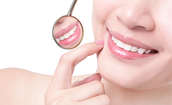 審美歯科の種類