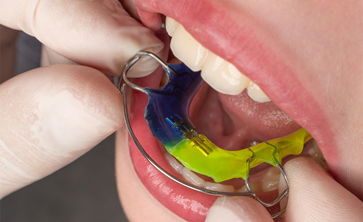 歯周病は知らないうちに歯ぐきの骨がなくなる恐ろしい病気です